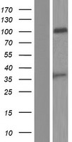 PSG8 Protein - Western validation with an anti-DDK antibody * L: Control HEK293 lysate R: Over-expression lysate