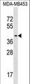 PSG9 Antibody - PSG9 Antibody western blot of MDA-MB453 cell line lysates (35 ug/lane). The PSG9 antibody detected the PSG9 protein (arrow).