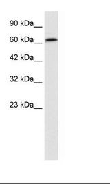 PSIP1 / LEDGF Antibody - Jurkat Cell Lysate.  This image was taken for the unconjugated form of this product. Other forms have not been tested.