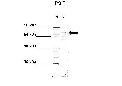 PSIP1 / LEDGF Antibody - Western blot of Anti-PSIP1 Ab at a dilution of 1:1000. Lane 1: 5ug mouse brain cytoplasm. Lane 2: 5ug mouse brain nucleus.
