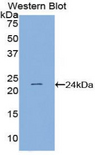 PSIP1 / LEDGF Antibody - Western blot of recombinant PSIP1 / LEDGF / p75.  This image was taken for the unconjugated form of this product. Other forms have not been tested.