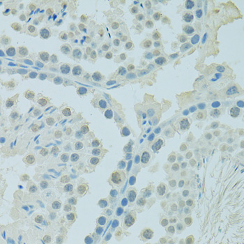 PSIP1 / LEDGF Antibody - Immunohistochemistry of paraffin-embedded mouse testis using PSIP1 antibody at dilution of 1:100 (40x lens).