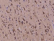 PSK / SEZ6L2 Antibody - Immunochemical staining of human SEZ6L2 in human brain with rabbit polyclonal antibody at 1:200 dilution, formalin-fixed paraffin embedded sections.