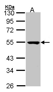 PSKH1 Antibody - Sample (30 ug of whole cell lysate). A: Molt-4 . 10 % SDS PAGE. PSKH1 antibody diluted at 1:1000