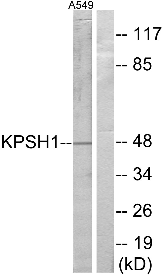 PSKH1 Antibody - Western blot analysis of lysates from A549 cells, using KPSH1 Antibody. The lane on the right is blocked with the synthesized peptide.