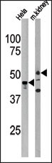 PSKH1 Antibody - Western blot of anti-PSKH1 Antibody (N-term H70) in HeLa cell line lysate and mouse kidney tissue lysate (35 ug/lane). PSKH1 (arrow) was detected using the purified antibody.