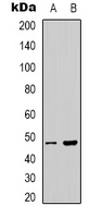 PSKH1 Antibody - Western blot analysis of PSKH1 expression in HeLa (A); HepG2 (B) whole cell lysates.