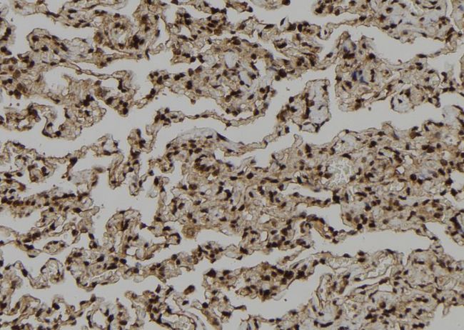 PSKH1 Antibody - 1:100 staining human lung tissue by IHC-P. The sample was formaldehyde fixed and a heat mediated antigen retrieval step in citrate buffer was performed. The sample was then blocked and incubated with the antibody for 1.5 hours at 22°C. An HRP conjugated goat anti-rabbit antibody was used as the secondary.