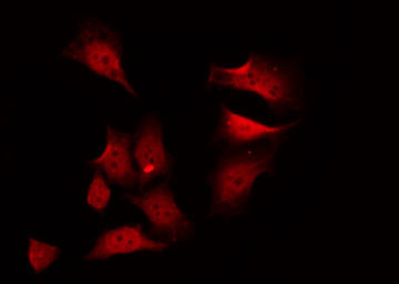 PSKH1 Antibody - Staining A549 cells by IF/ICC. The samples were fixed with PFA and permeabilized in 0.1% Triton X-100, then blocked in 10% serum for 45 min at 25°C. The primary antibody was diluted at 1:200 and incubated with the sample for 1 hour at 37°C. An Alexa Fluor 594 conjugated goat anti-rabbit IgG (H+L) Ab, diluted at 1/600, was used as the secondary antibody.