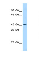 PSKH2 Antibody - PSKH2 antibody Western blot of Fetal Lung lysate. Antibody concentration 1 ug/ml.  This image was taken for the unconjugated form of this product. Other forms have not been tested.