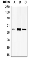 PSKH2 Antibody - Western blot analysis of PSKH2 expression in HeLa (A); HEK293T (B); mouse brain (C) whole cell lysates.
