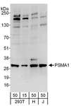 PSMA1 Antibody - Detection of Human PSMA1 by Western Blot. Samples: Whole cell lysate from 293T (15 and 50 ug), HeLa (H; 50 ug), and Jurkat (J; 50 ug) cells. Antibodies: Affinity purified rabbit anti-PSMA1 antibody used for WB at 0.1 ug/ml. Detection: Chemiluminescence with an exposure time of 30 seconds.