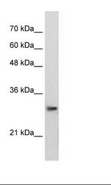 PSMA1 Antibody - Jurkat Cell Lysate.  This image was taken for the unconjugated form of this product. Other forms have not been tested.