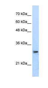 PSMA1 Antibody - PSMA1 antibody Western blot of Jurkat lysate. This image was taken for the unconjugated form of this product. Other forms have not been tested.