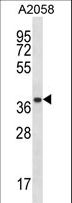 PSMA1 Antibody - PSMA1 Antibody western blot of A2058 cell line lysates (35 ug/lane). The PSMA1 antibody detected the PSMA1 protein (arrow).