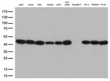PSMA1 Antibody - Western blot analysis of extracts. (35ug) from 8 cell lines and 2 tissue lysates by using anti-PSMA1 monoclonal antibody. (1:250)