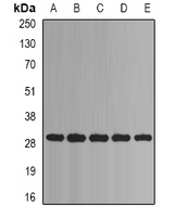 PSMA1 Antibody - Western blot analysis of PSMA1 expression in Jurkat (A); HeLa (B); HepG2 (C); mouse liver (D); mouse heart (E) whole cell lysates.