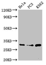 PSMA1 Antibody - Western Blot Positive WB detected in:Hela whole cell lysate,PC3 whole cell lysate,K562 whole cell lysate All Lanes:PSMA1 antibody at 3.4µg/ml Secondary Goat polyclonal to rabbit IgG at 1/50000 dilution Predicted band size: 30,31 KDa Observed band size: 30 KDa