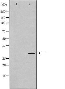 PSMA1 Antibody - Western blot analysis of HeLa whole cells lysates using PSMA1 antibody. The lane on the left is treated with the antigen-specific peptide.