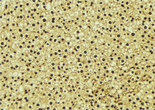 PSMA1 Antibody - 1:100 staining mouse liver tissue by IHC-P. The sample was formaldehyde fixed and a heat mediated antigen retrieval step in citrate buffer was performed. The sample was then blocked and incubated with the antibody for 1.5 hours at 22°C. An HRP conjugated goat anti-rabbit antibody was used as the secondary.
