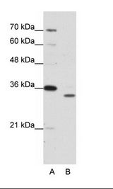 PSMA1 Antibody - A: Marker, B: Jurkat Cell Lysate.  This image was taken for the unconjugated form of this product. Other forms have not been tested.