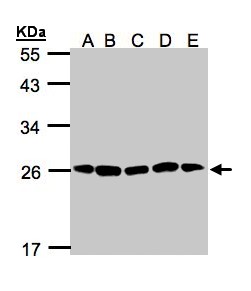 PSMA2 Antibody - Sample (30g of whole cell lysate). A: H1299, B: HeLa S3 , C: Hep G2 , D: MOLT4 , E: Raji . 12% SDS PAGE. PSMA2 / HC3 antibody diluted at 1:1000