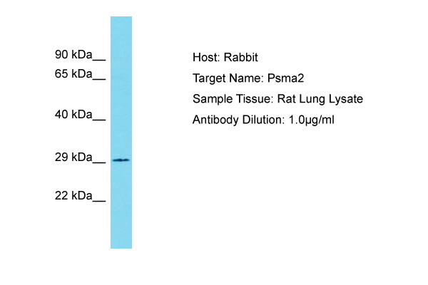 PSMA2 Antibody -  This image was taken for the unconjugated form of this product. Other forms have not been tested.