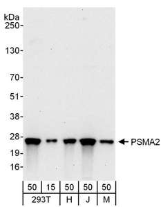 PSMA2 Antibody - Detection of Human and Mouse PSMA2 by Western Blot. Samples: Whole cell lysate from 293T (15 and 50 ug), HeLa (H; 50 ug), Jurkat (J; 50 ug) and mouse NIH3T3 (M; 50 ug) cells. Antibodies: Affinity purified rabbit anti-PSMA2 antibody used for WB at 0.1 ug/ml. Detection: Chemiluminescence with an exposure time of 30 seconds.