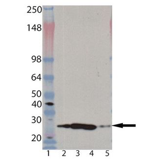PSMA2 Antibody - Western blot of Proteasome 20S alpha 2 subunit monoclonal antibody (MCP21): Lane 1: MW marker, Lane 2: HeLa (heat shocked), Lane 3: Jurkat, Lane 4: HeLa S100 fraction, Lane 5: Proteasome 26S (human), (purified).