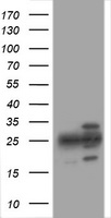 PSMA2 Antibody - HEK293T cells were transfected with the pCMV6-ENTRY control (Left lane) or pCMV6-ENTRY PSMA2 (Right lane) cDNA for 48 hrs and lysed. Equivalent amounts of cell lysates (5 ug per lane) were separated by SDS-PAGE and immunoblotted with anti-PSMA2.