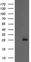 PSMA2 Antibody - HEK293T cells were transfected with the pCMV6-ENTRY control (Left lane) or pCMV6-ENTRY PSMA2 (Right lane) cDNA for 48 hrs and lysed. Equivalent amounts of cell lysates (5 ug per lane) were separated by SDS-PAGE and immunoblotted with anti-PSMA2.