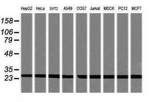 PSMA2 Antibody - Western blot of extracts (35 ug) from 9 different cell lines by using g anti-PSMA2 monoclonal antibody (HepG2: human; HeLa: human; SVT2: mouse; A549: human; COS7: monkey; Jurkat: human; MDCK: canine; PC12: rat; MCF7: human).