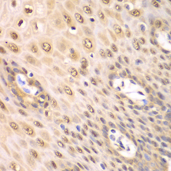 PSMA2 Antibody - Immunohistochemistry of paraffin-embedded human esophageal tissue.