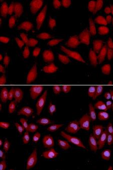PSMA2 Antibody - Immunofluorescence analysis of U2OS cells.