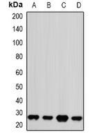 PSMA2 Antibody - Western blot analysis of PSMA2 expression in Jurkat (A); HeLa (B); NIH3T3 (C); mouse brain (D) whole cell lysates.