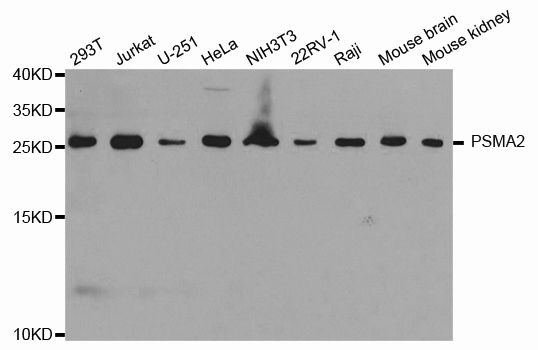 PSMA2 Antibody - Western blot analysis of extracts of various cell lines, using PSMA2 antibody at 1:1000 dilution. The secondary antibody used was an HRP Goat Anti-Rabbit IgG (H+L) at 1:10000 dilution. Lysates were loaded 25ug per lane and 3% nonfat dry milk in TBST was used for blocking.
