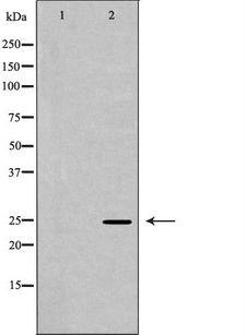 PSMA2 Antibody - Western blot analysis of HeLa whole cells lysates using PSMA2 antibody. The lane on the left is treated with the antigen-specific peptide.
