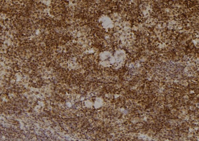 PSMA2 Antibody - 1:100 staining mouse spleen tissue by IHC-P. The sample was formaldehyde fixed and a heat mediated antigen retrieval step in citrate buffer was performed. The sample was then blocked and incubated with the antibody for 1.5 hours at 22°C. An HRP conjugated goat anti-rabbit antibody was used as the secondary.
