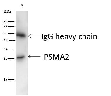 PSMA2 Antibody - Galectin3 was immunoprecipitated using: Lane A: 0.5 mg A431 Whole Cell Lysate. 4 uL anti-Galectin3 rabbit monoclonal antibody and 60 ug of Immunomagnetic beads Protein A/G. Primary antibody: Anti-Galectin3 rabbit monoclonal antibody, at 1:100 dilution. Secondary antibody: Goat Anti-Rabbit IgG (H+L)/HRP at 1/10000 dilution. Developed using the ECL technique. Performed under reducing conditions. Predicted band size: 26 kDa. Observed band size: 30 kDa.