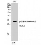 PSMA3 Antibody - Western blot of Phospho-20S Proteasome alpha3 (S250) antibody