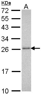 PSMA3 Antibody - Sample (30 ug of whole cell lysate). A: Molt-4 . 12% SDS PAGE. HC8 / PSMA3 antibody diluted at 1:1000.