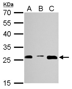 PSMA3 Antibody - Proteasome 20S alpha 3 antibody detects PSMA3 protein by Western blot analysis. A. 30 ug NIH-3T3 whole cell lysate/extract. B. 30 ug JC whole cell lysate/extract. C. 30 ug BCL-1 whole cell lysate/extract. 12 % SDS-PAGE. Proteasome 20S alpha 3 antibody dilution:1:1000.