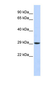 PSMA3 Antibody - PSMA3 antibody Western blot of Fetal Brain lysate. This image was taken for the unconjugated form of this product. Other forms have not been tested.