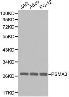 PSMA3 Antibody - Western blot of PSMA3 pAb in extracts from JAR, A549 and PC12 cells.