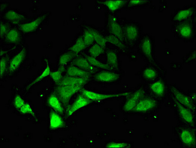 PSMA3 Antibody - Immunofluorescent analysis of Hela cells using PSMA3 Antibody at dilution of 1:100 and Alexa Fluor 488-congugated AffiniPure Goat Anti-Rabbit IgG(H+L)