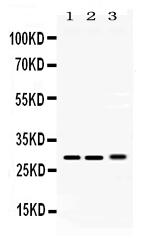 PSMA3 Antibody - Western blot analysis of PSMA3 using anti-PSMA3 antibody. Electrophoresis was performed on a 5-20% SDS-PAGE gel at 70V (Stacking gel) / 90V (Resolving gel) for 2-3 hours. The sample well of each lane was loaded with 50ug of sample under reducing conditions. Lane 1: rat testis tissue lysates, Lane 2: mouse lung tissue lysates, Lane 3: 293T whole cell lysates, After Electrophoresis, proteins were transferred to a Nitrocellulose membrane at 150mA for 50-90 minutes. Blocked the membrane with 5% Non-fat Milk/ TBS for 1.5 hour at RT. The membrane was incubated with rabbit anti-PSMA3 antigen affinity purified polyclonal antibody at 0.5 µg/mL overnight at 4°C, then washed with TBS-0.1% Tween 3 times with 5 minutes each and probed with a goat anti-rabbit IgG-HRP secondary antibody at a dilution of 1:10000 for 1.5 hour at RT. The signal is developed using an Enhanced Chemiluminescent detection (ECL) kit with Tanon 5200 system. A specific band was detected for PSMA3 at approximately 28KD. The expected band size for PSMA3 is at 28KD.