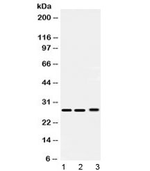 PSMA3 Antibody - Western blot testing of 1) rat testis, 2) mouse lung and 3) human 293T lysate with PSMA3 antibody at 0.5ug/ml. Predicted/observed molecular weight ~28 kDa.