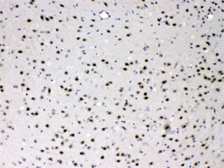 PSMA3 Antibody - IHC testing of FFPE mouse brain with PSMA3 antibody at 1ug/ml. HIER: steam section in pH6 citrate buffer for 20 min.