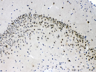 PSMA3 Antibody - IHC testing of FFPE rat brain with PSMA3 antibody at 1ug/ml. HIER: steam section in pH6 citrate buffer for 20 min.