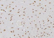 PSMA3 Antibody - 1:100 staining human brain tissue by IHC-P. The sample was formaldehyde fixed and a heat mediated antigen retrieval step in citrate buffer was performed. The sample was then blocked and incubated with the antibody for 1.5 hours at 22°C. An HRP conjugated goat anti-rabbit antibody was used as the secondary.